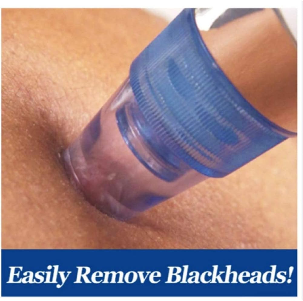 Pore Cleaning Device | Blackhead Remover Vacuum USB Rechargeable