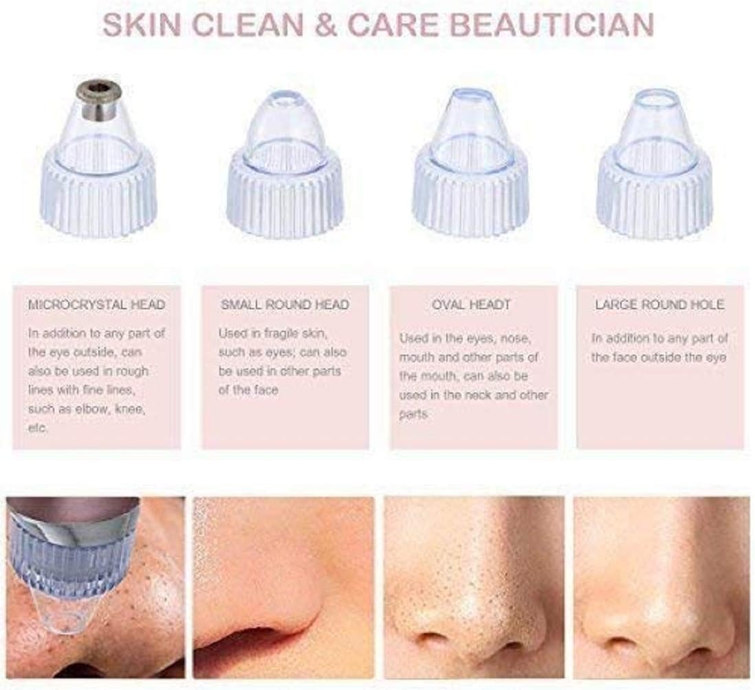 Pore Cleaning Device | Blackhead Remover Vacuum USB Rechargeable