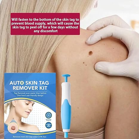Acrochordon Skin Tag Remover Kit – 2-in-1 Fast & Painless Solution