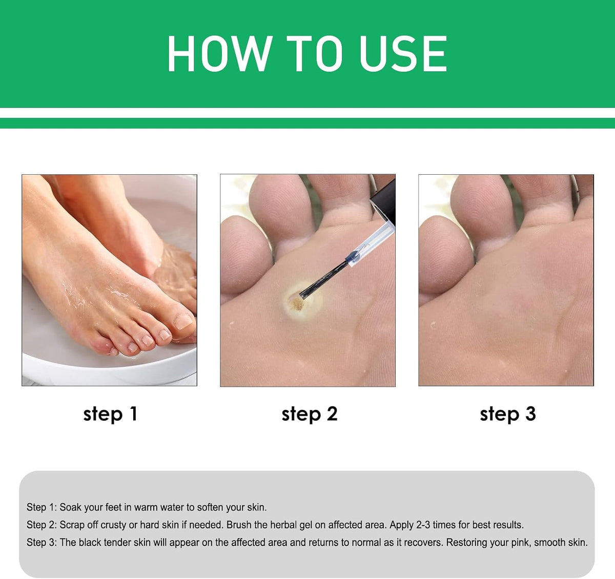 Active Corn Remover Gel – Lifestyle Accessories