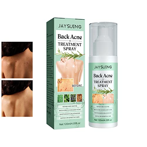 Back Acne Treatment Spray – Skincare Face Care