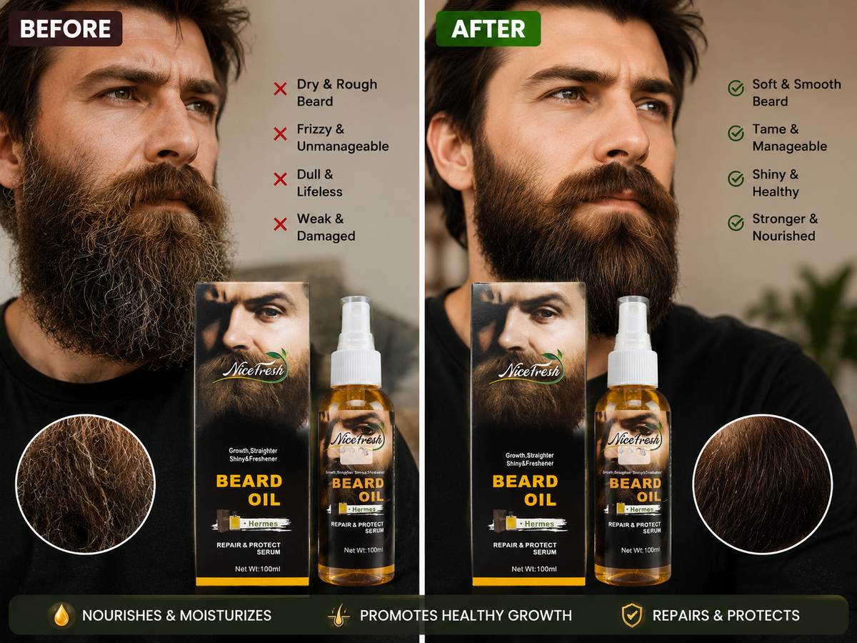 NiceFresh Beard Growth Oil – Lifestyle Accessories