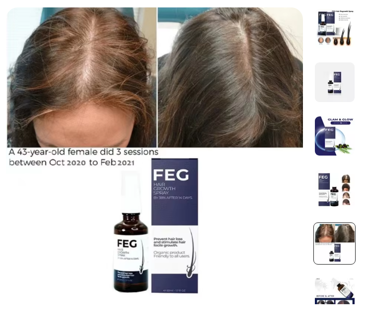 FEG Hair Growth Spray – Stop Hair Fall, Regrow Naturally & Strengthen Roots
