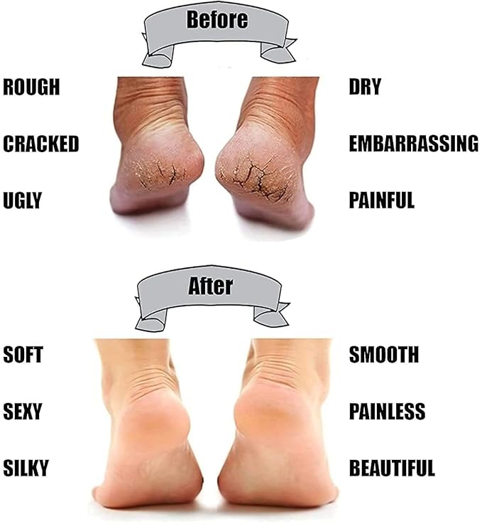 Anti Foot Crack – Kitchen Storage Organization