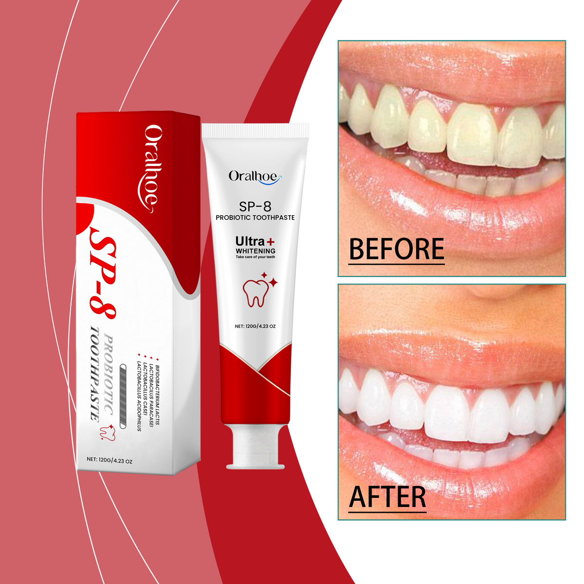 SP-8 Probiotic Dental Care Toothpaste – Oral Care