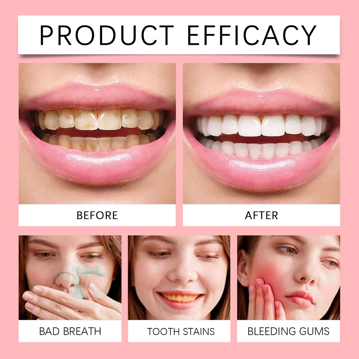 SP-8 Probiotic Dental Care Toothpaste – Oral Care