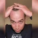FEG Hair Growth Spray – Stop Hair Fall, Regrow Naturally & Strengthen Roots