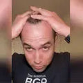 FEG Hair Growth Spray – Stop Hair Fall, Regrow Naturally & Strengthen Roots