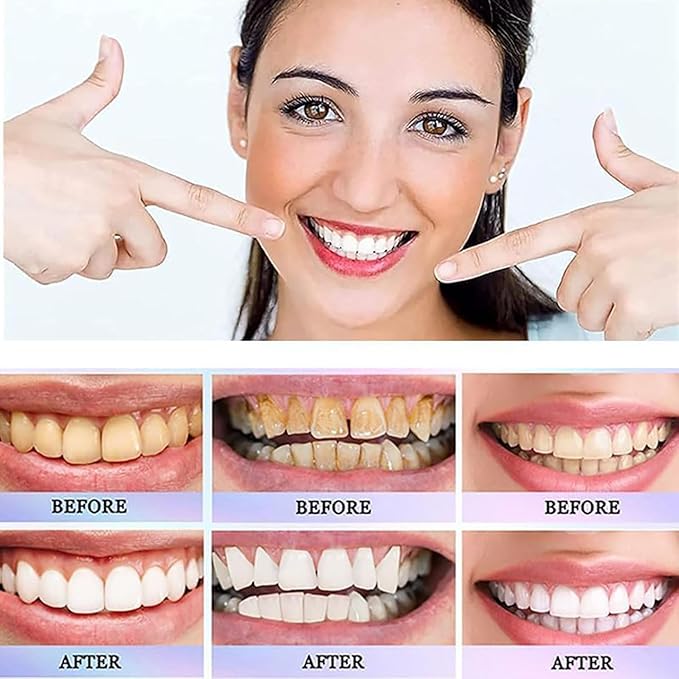 Oralhoe - Nicotinamide Dazzle White Toothpaste 2