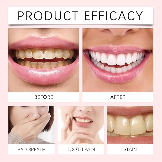 Oralhoe - Nicotinamide Dazzle White Toothpaste 2