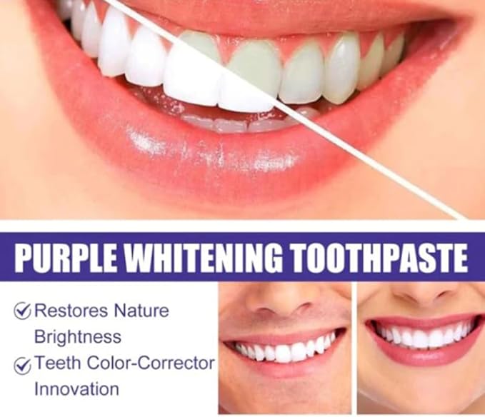 Purple Whitening Toothpaste – Skincare Face Care