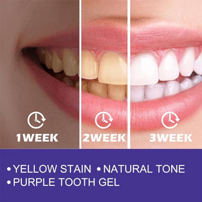 Purple Whitening Toothpaste – Skincare Face Care