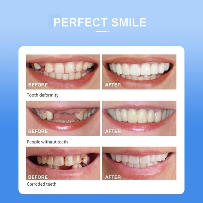 Snap On Smile – Home & Kitchen