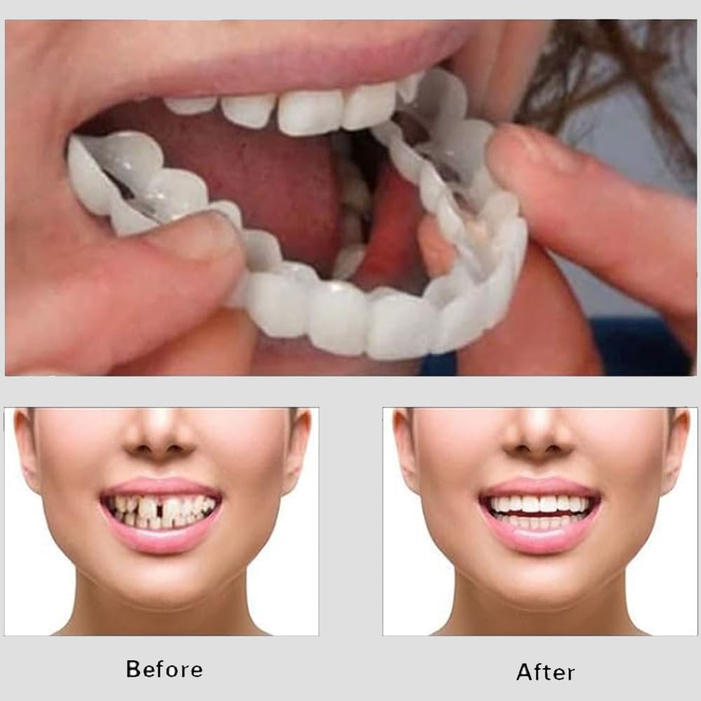 Snap On Smile – Home & Kitchen