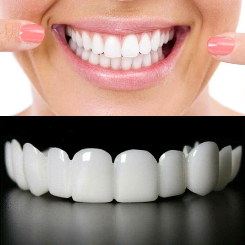 Snap On Smile – Home & Kitchen