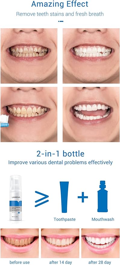 Teeth Whitening Mousse – Skincare Face Care